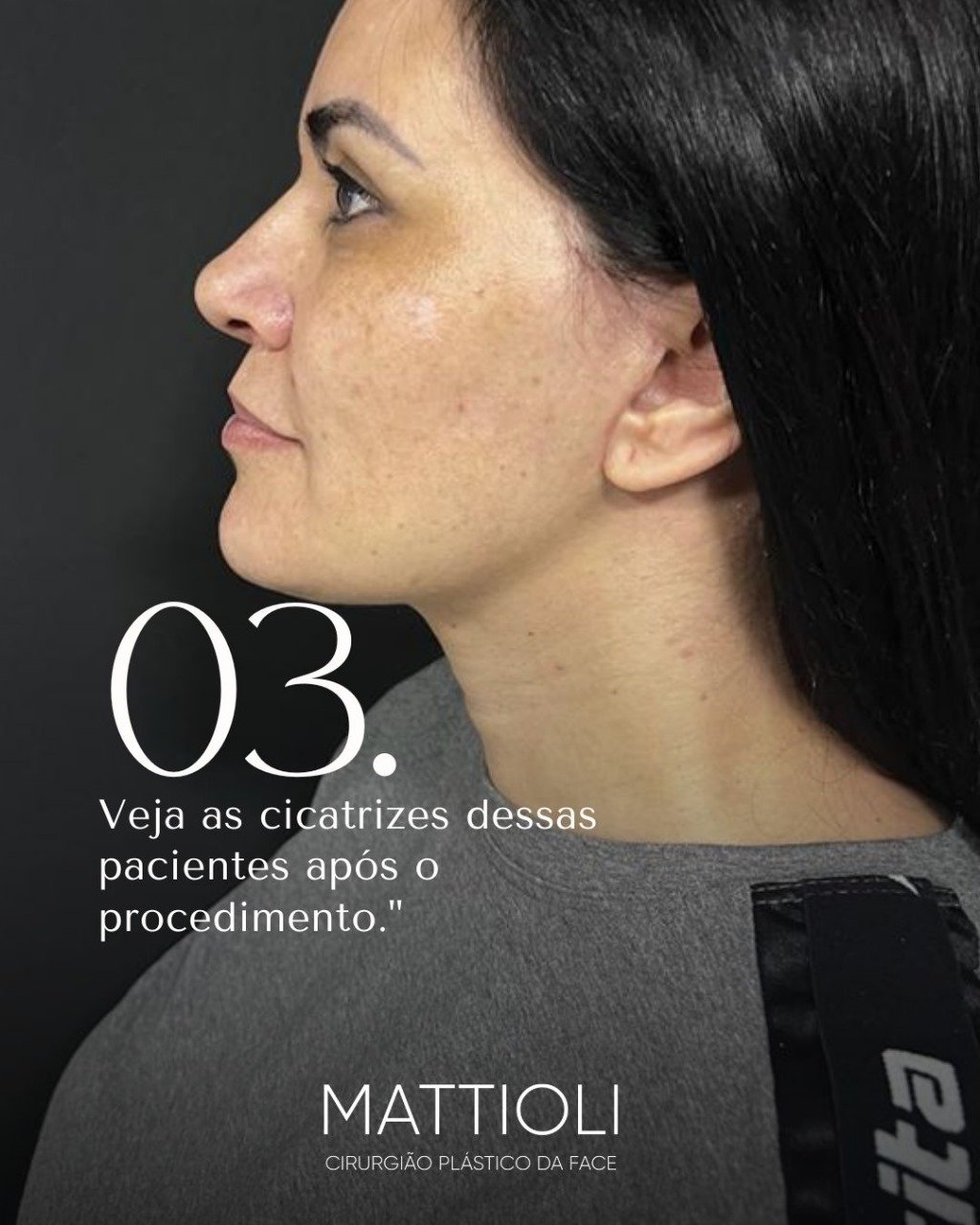 mattioli004