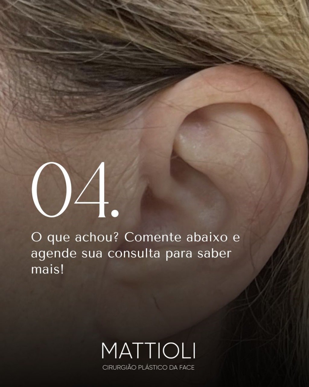 mattioli005